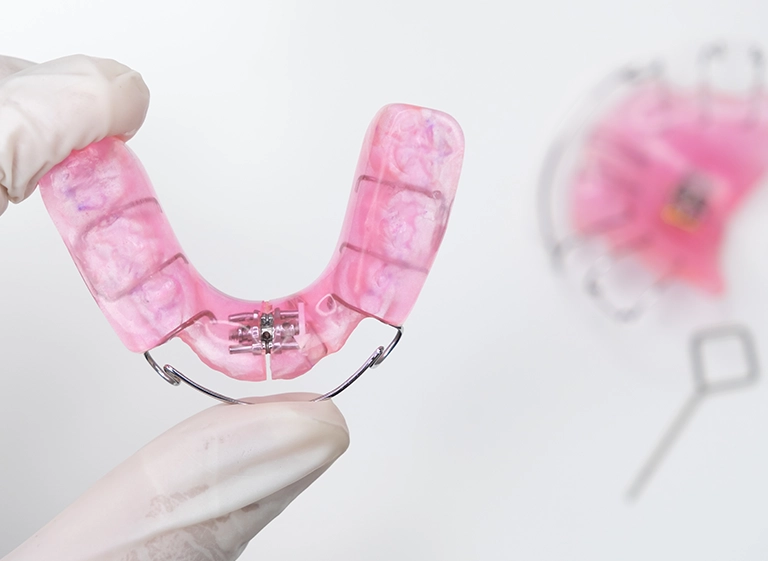 różowy aparat na zęby